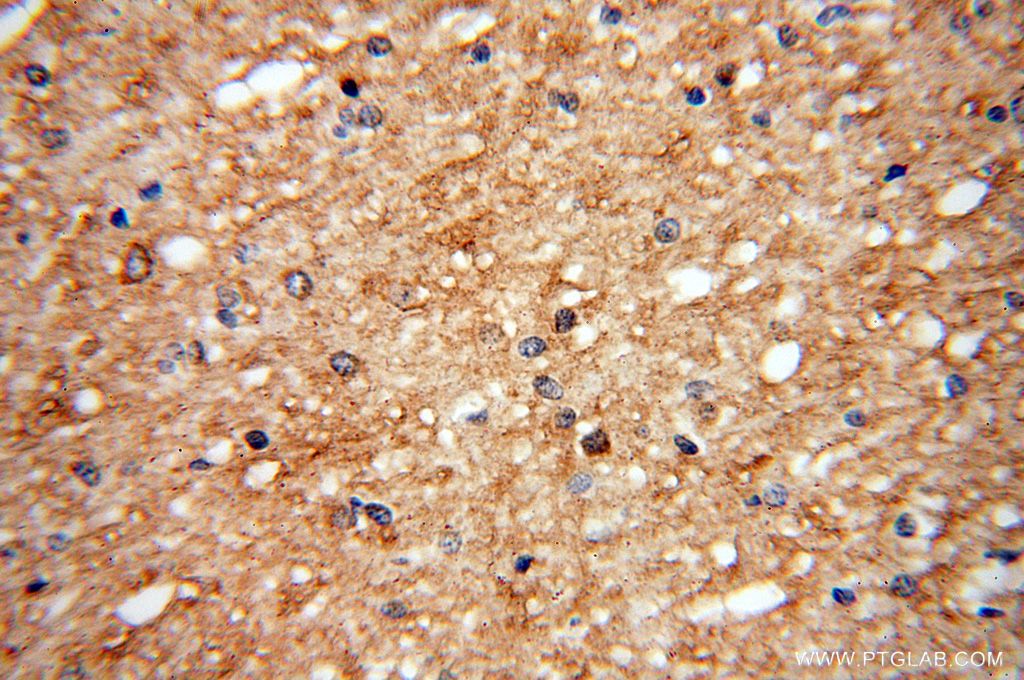 UGT8 Polyclonal antibody