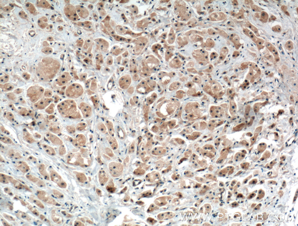PRKAR1B Polyclonal antibody