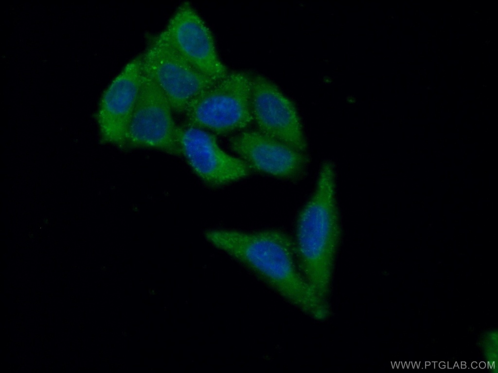RBMX2 Polyclonal antibody