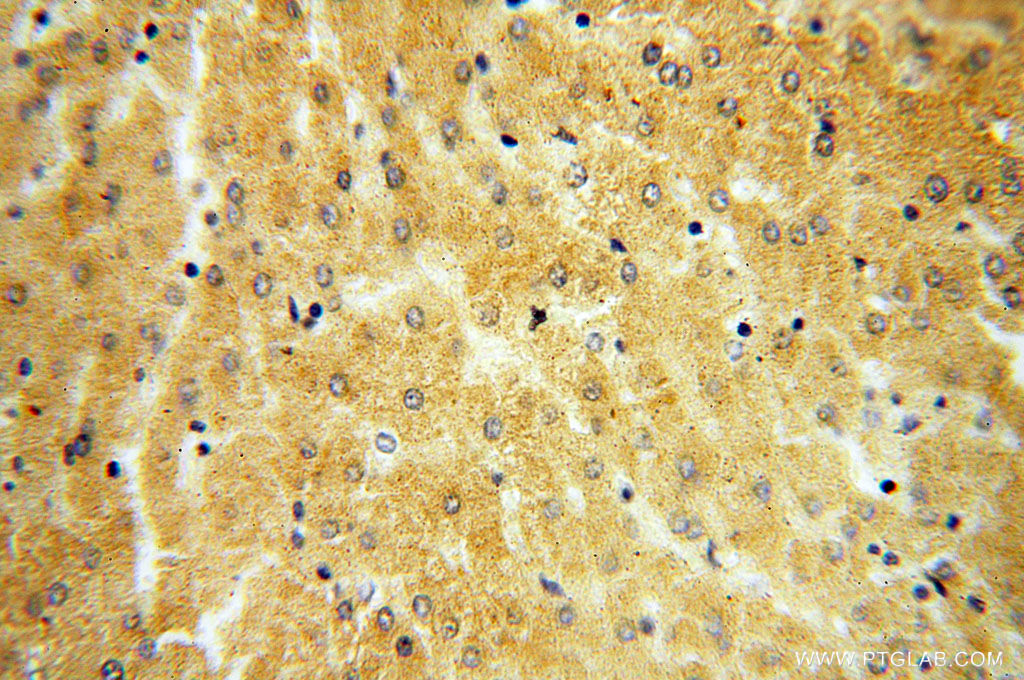 ST8SIA3 Polyclonal antibody
