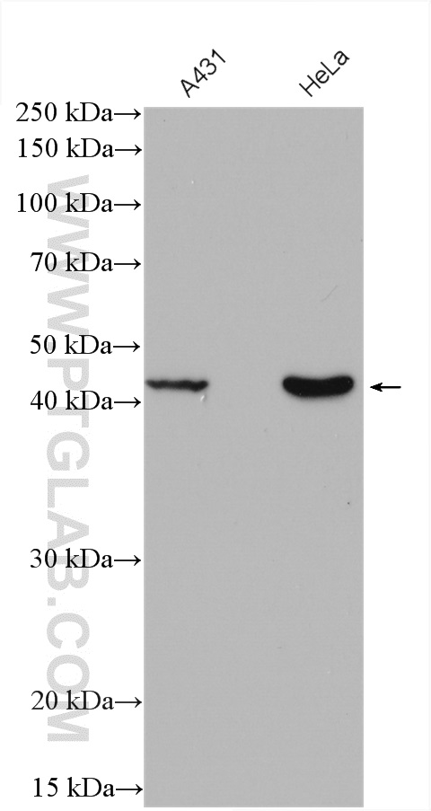 RRM2B,p53R2 Polyclonal antibody