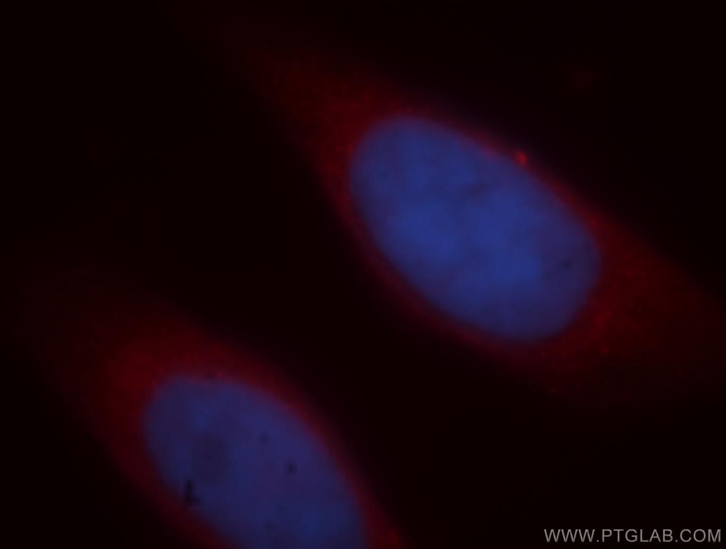 ICA1L Polyclonal antibody