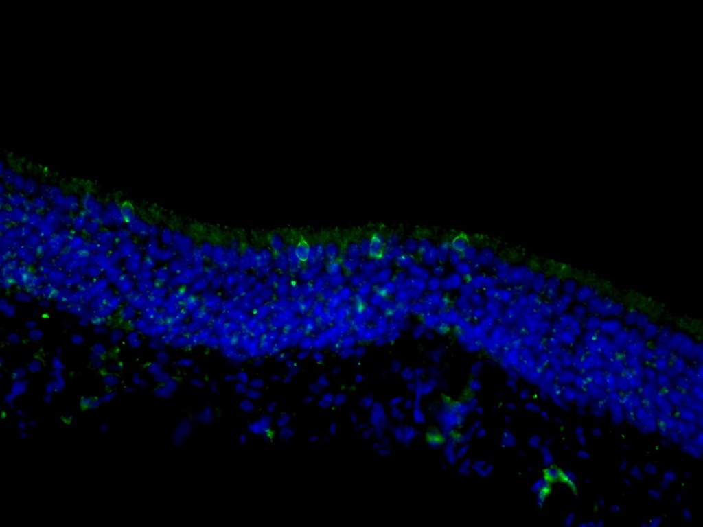 TRPM5 Polyclonal antibody