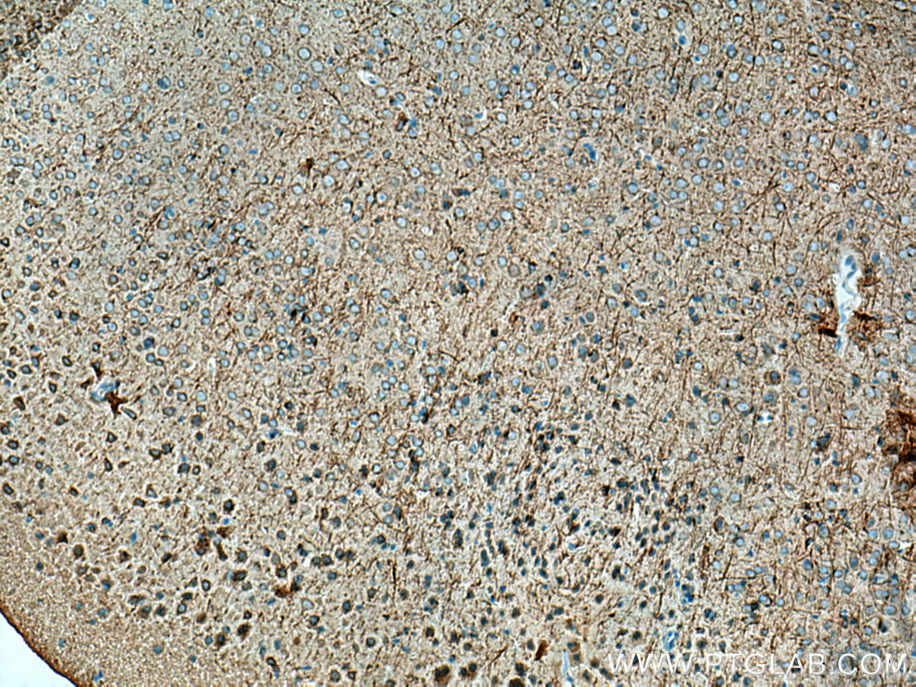 STYK1 Polyclonal antibody