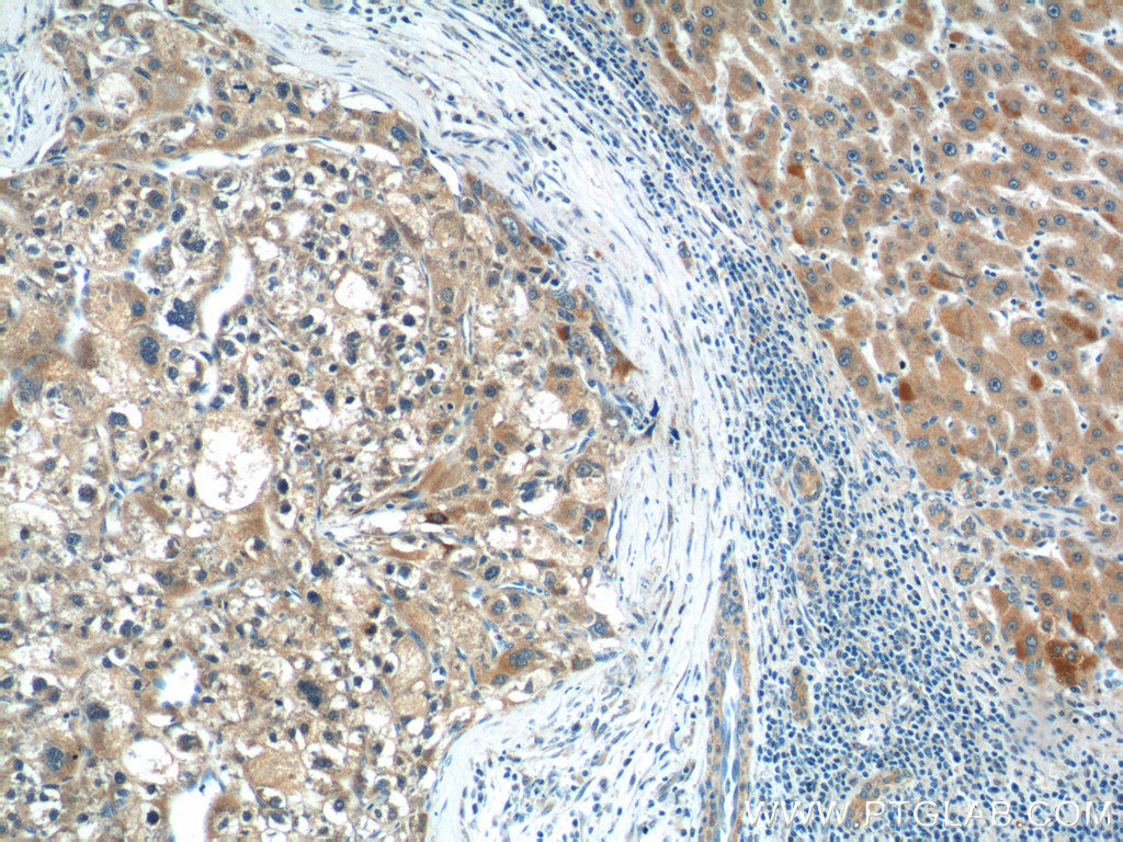 CGNL1 Polyclonal antibody