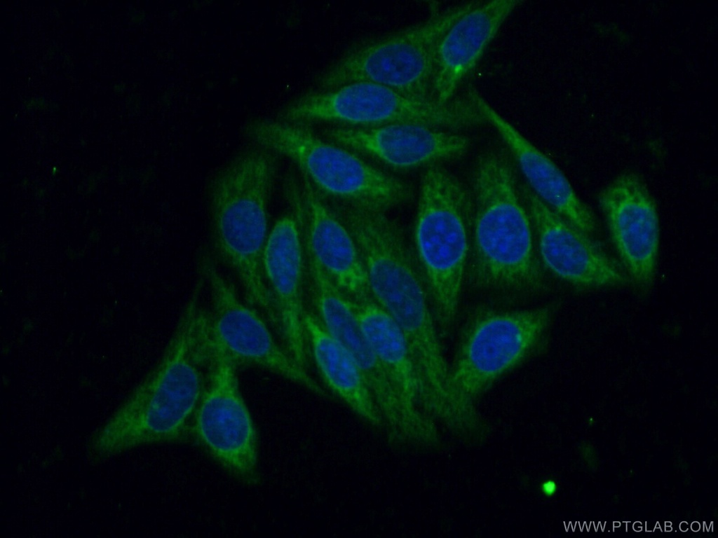 LONP2 Polyclonal antibody
