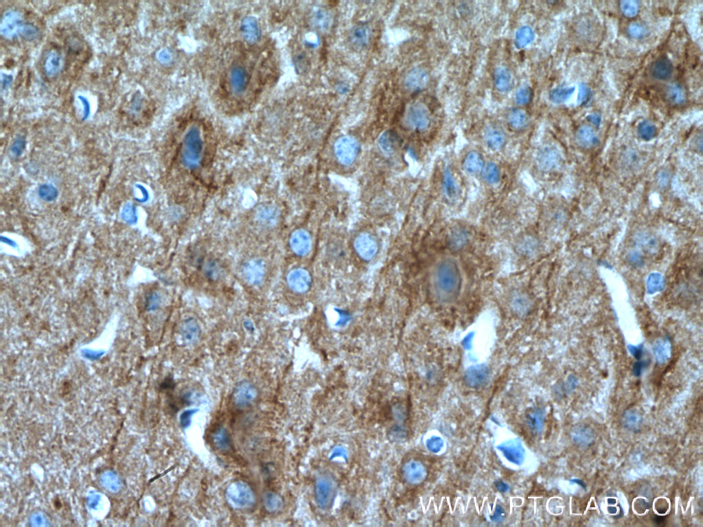 SAP102 Polyclonal antibody