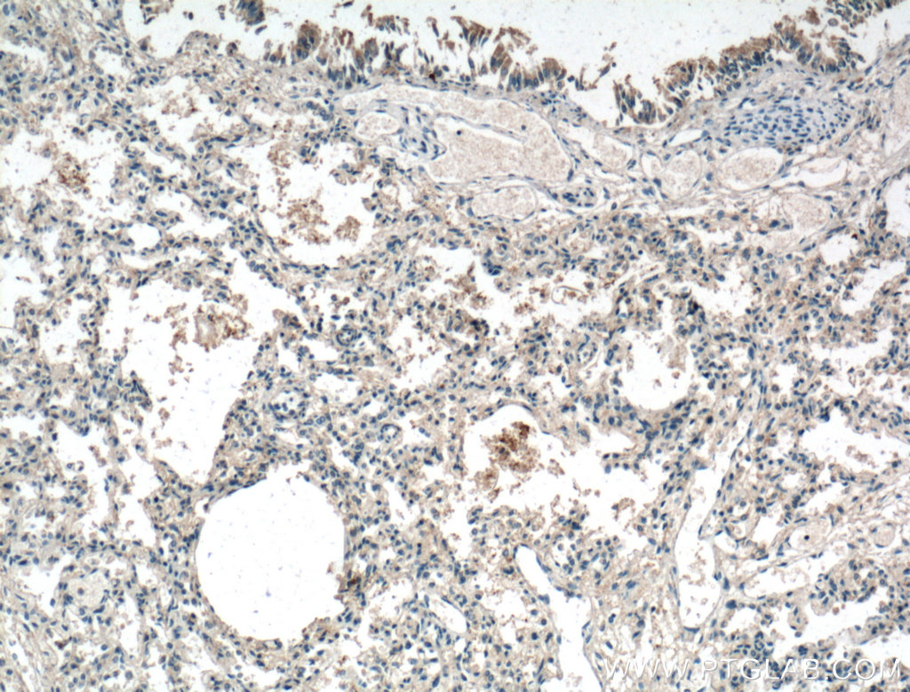 IL-36 Beta/IL-1F8 Polyclonal antibody