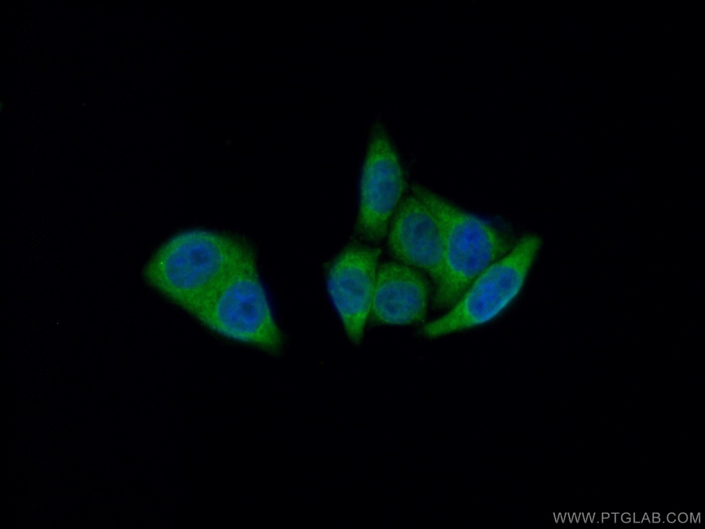 DEFA1 Polyclonal antibody