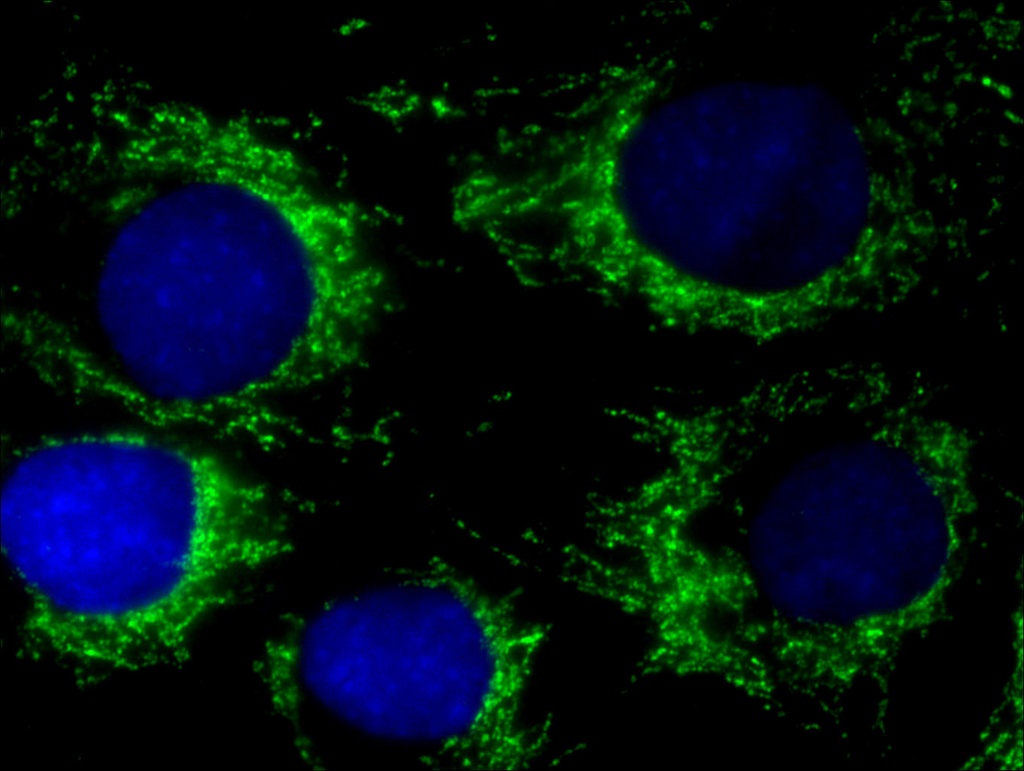 PDH E1 Alpha Polyclonal antibody