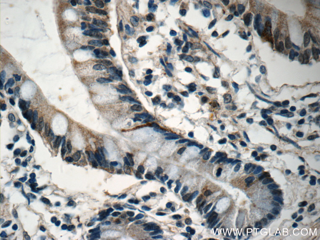 DNAH6 Polyclonal antibody