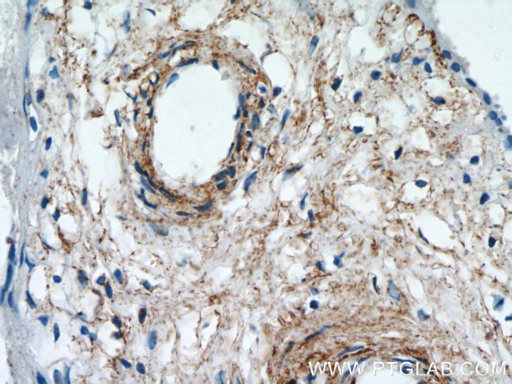 KCNC4 Polyclonal antibody