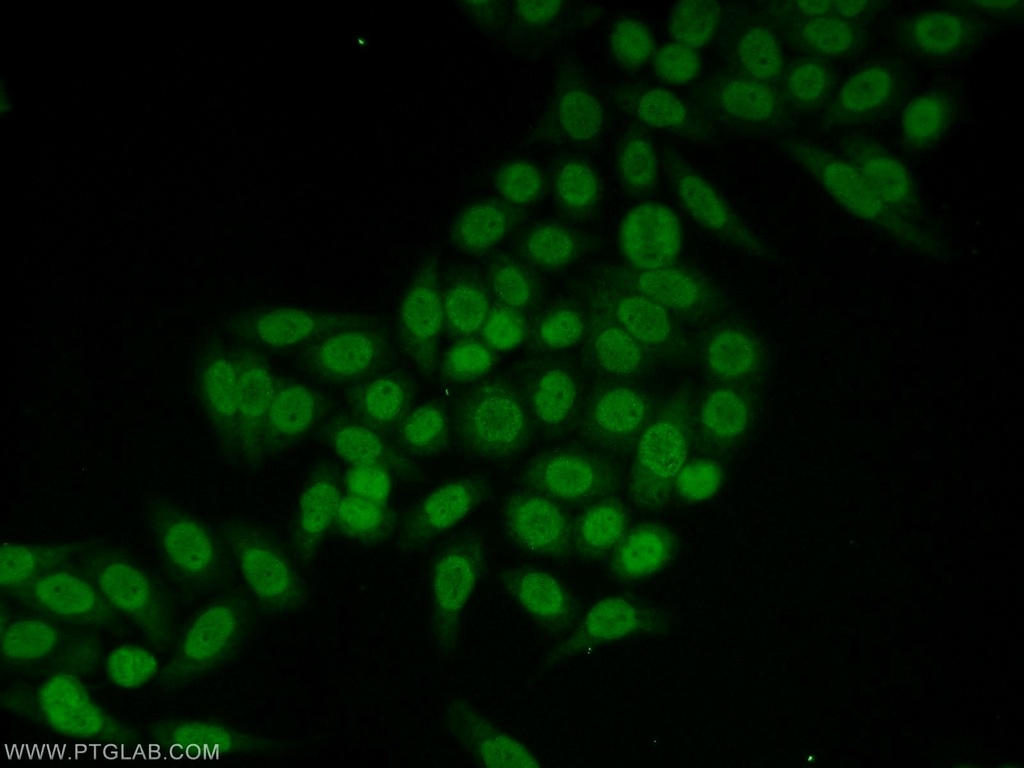 CLOCK Polyclonal antibody