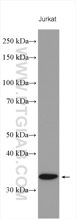 CENPP Polyclonal antibody