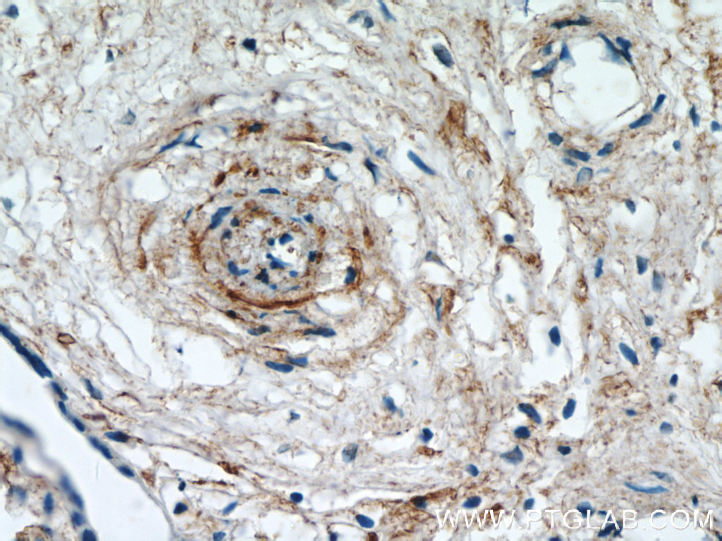 KCNA10 Polyclonal antibody