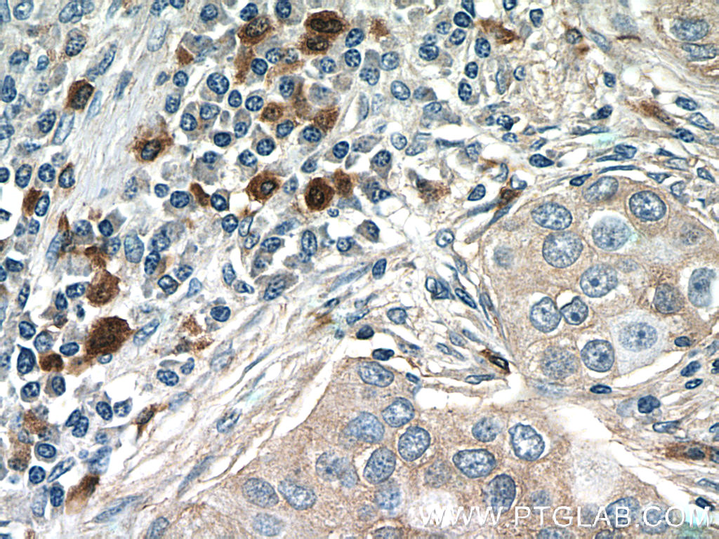 CXCL17 Polyclonal antibody