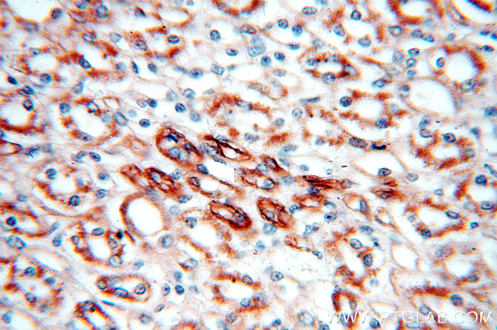 KLHL20 Polyclonal antibody