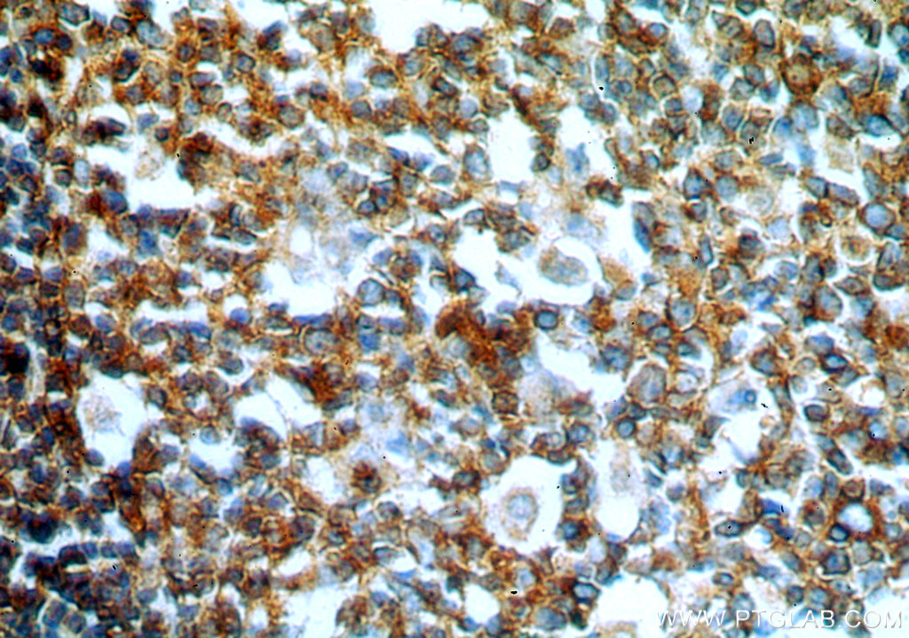 GCNT2 Polyclonal antibody