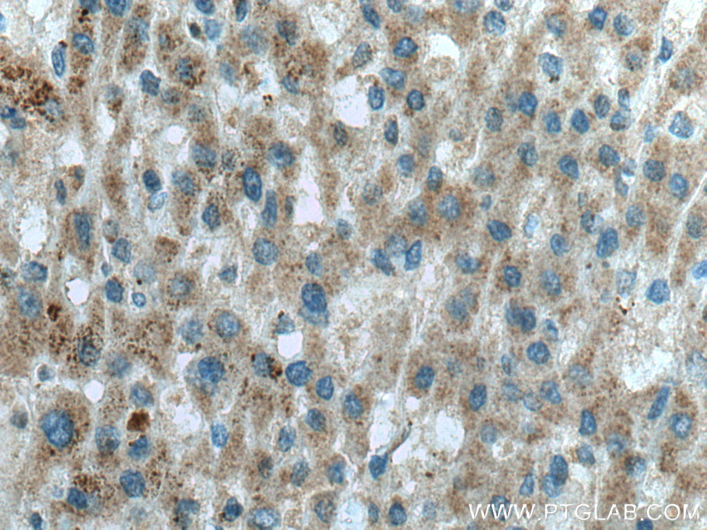 OTOR Polyclonal antibody