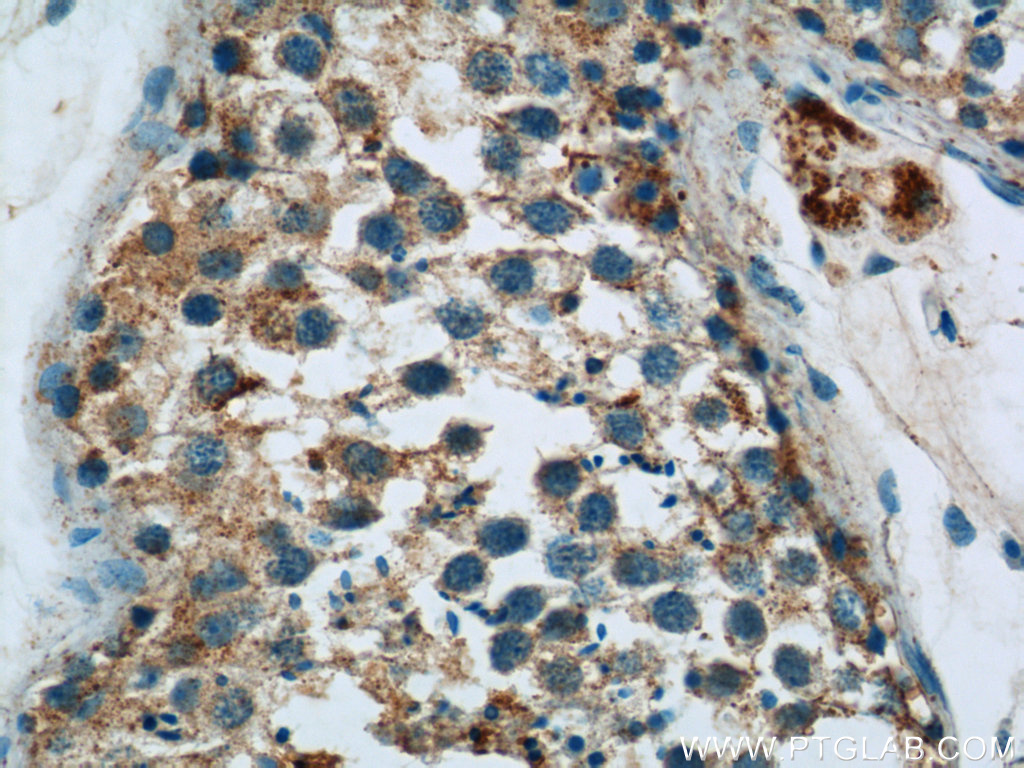 HYAL4 Polyclonal antibody