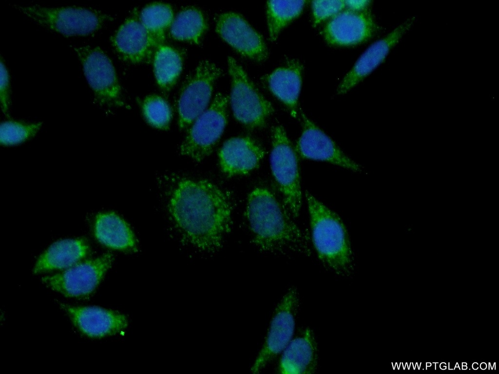 HRC Polyclonal antibody