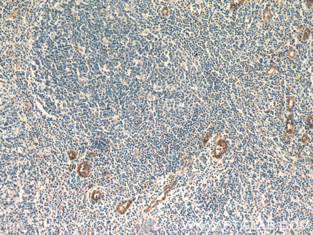 Stabilin-1 Polyclonal antibody