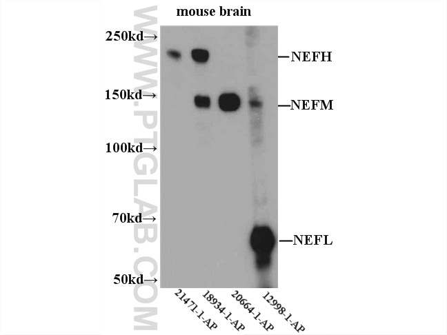 NF-M-Specific Polyclonal antibody
