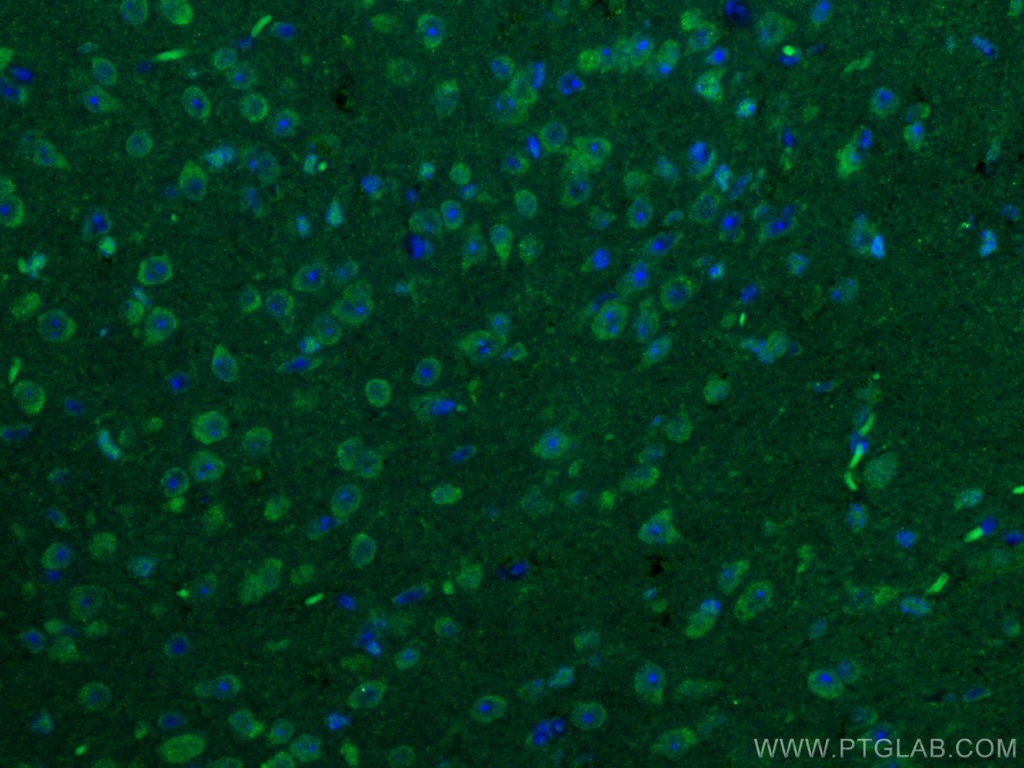 CaMKII alpha-Specific Polyclonal antibody