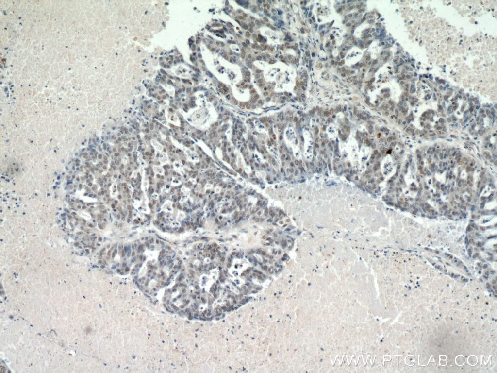 CTR9 Polyclonal antibody