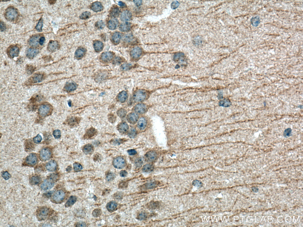 LIS1 Polyclonal antibody