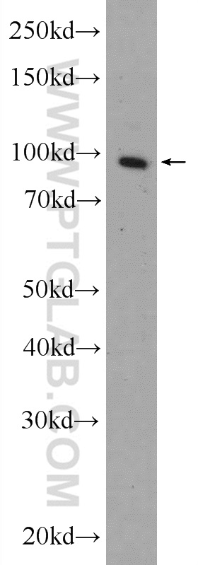 Transportin-1 Polyclonal antibody