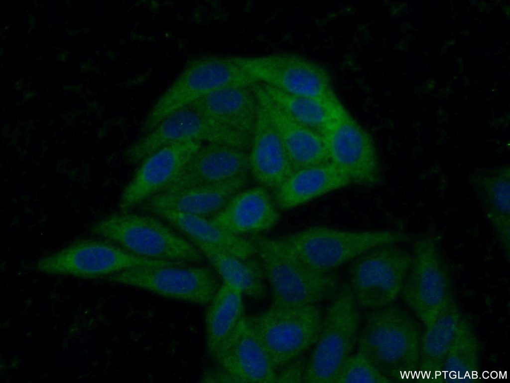 ABCA2 Polyclonal antibody