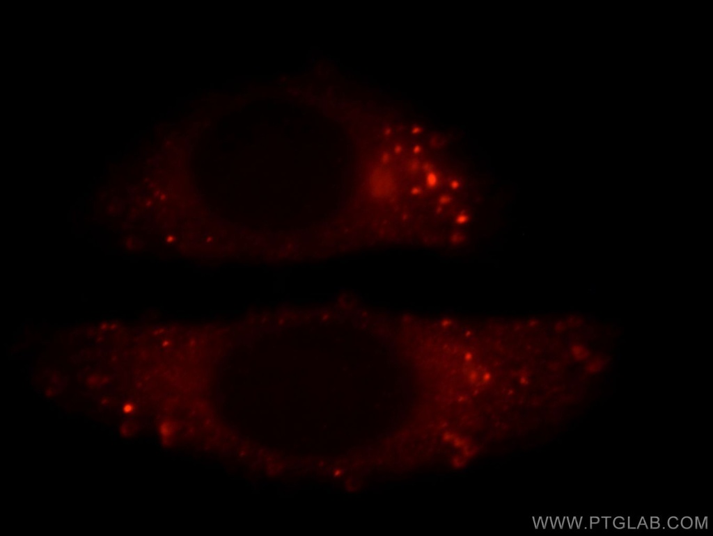 FLNB Polyclonal antibody