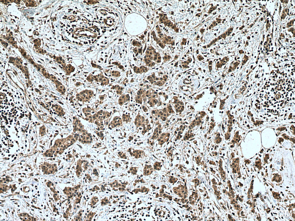 NOTCH1 Polyclonal antibody