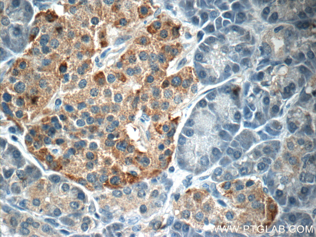 SSTR3 Polyclonal antibody