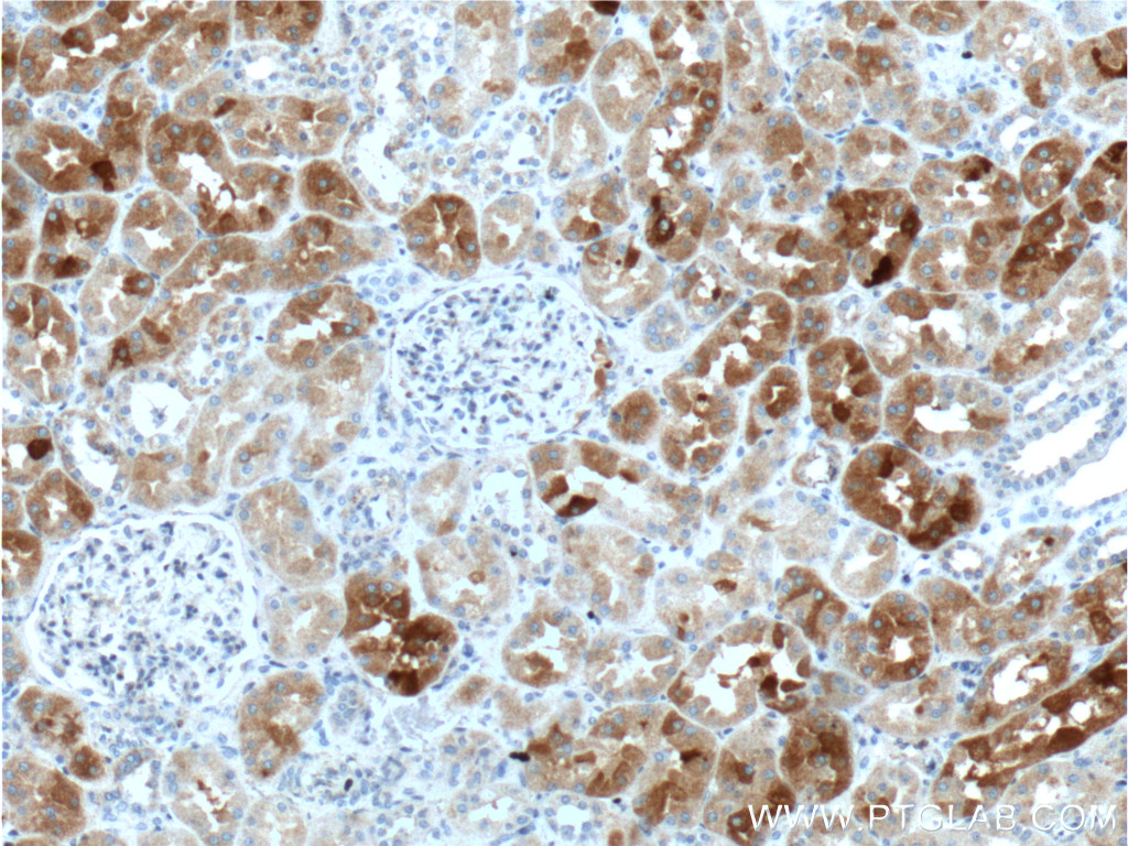 GHRHR Polyclonal antibody