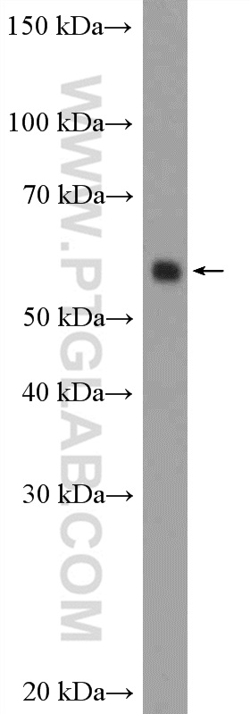 ARX Polyclonal antibody