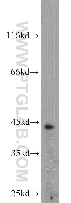 Brachyury-T Polyclonal antibody
