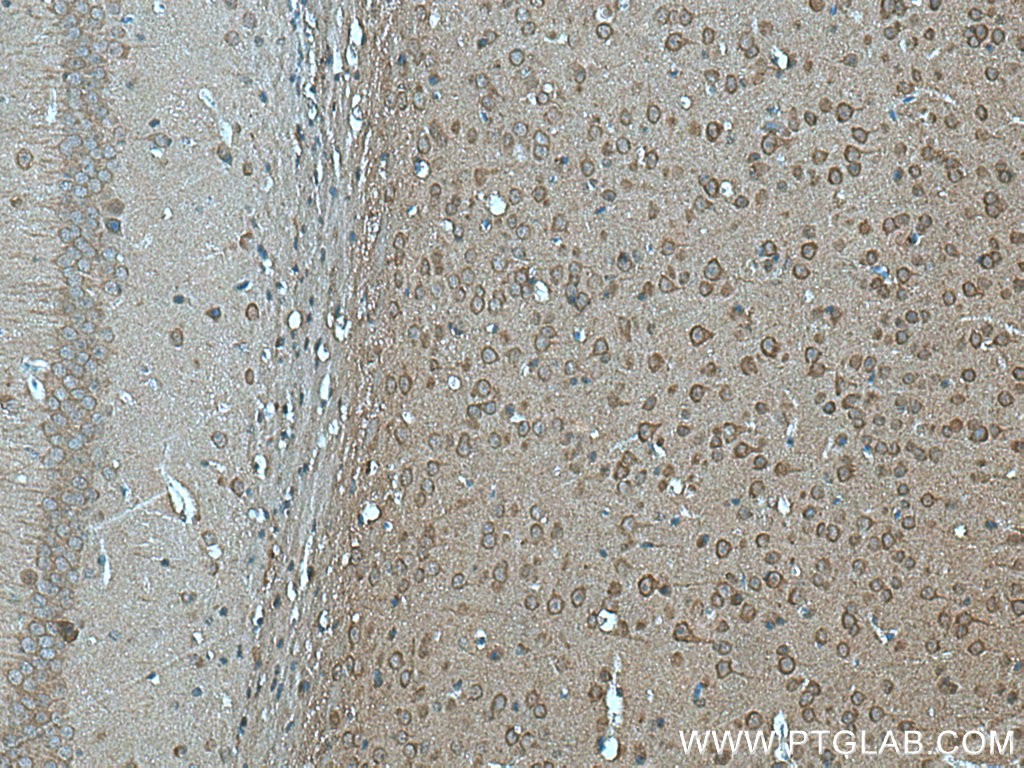 FAM57B Polyclonal antibody