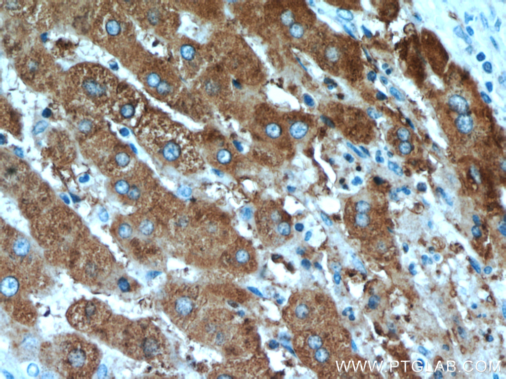 TRMT2B Polyclonal antibody