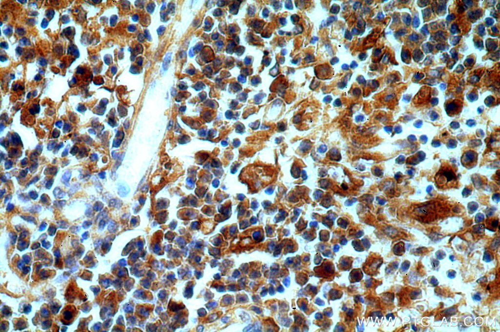Serum amyloid P component Polyclonal antibody