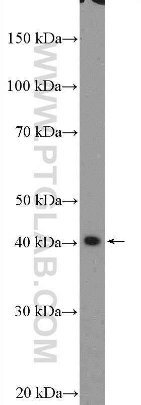 PDCD2L Polyclonal antibody