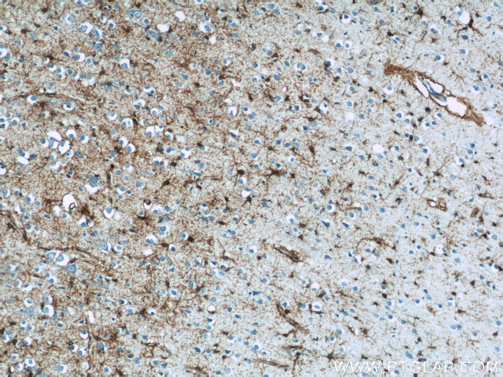 GLAST Polyclonal antibody