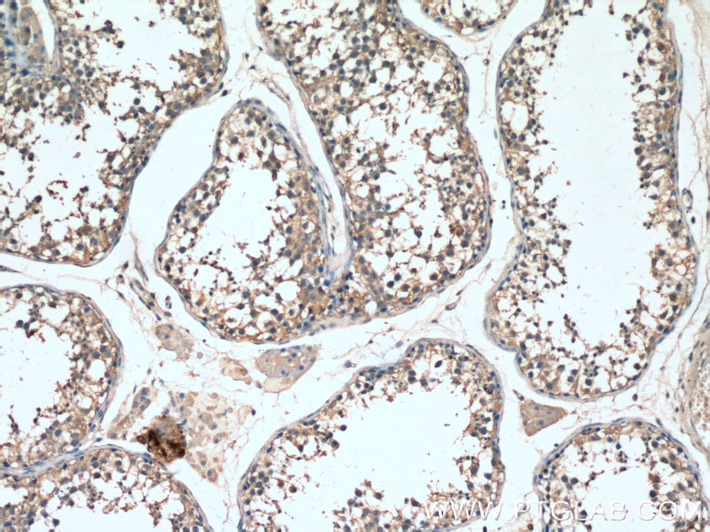 SMO Polyclonal antibody