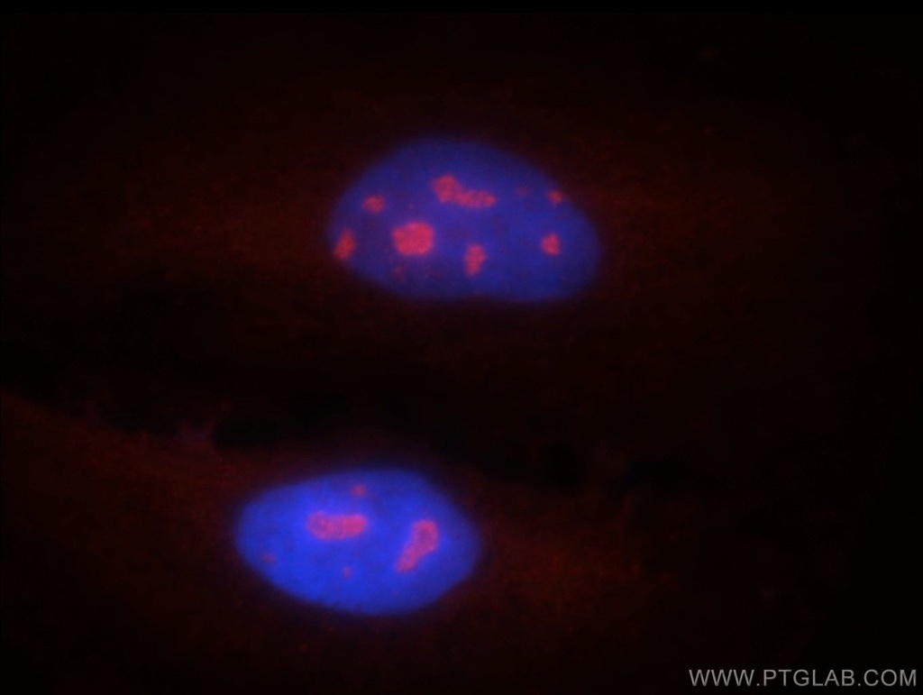 HMGA2 Polyclonal antibody