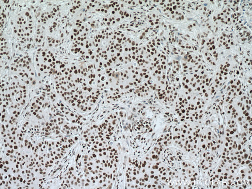 NUP50 Polyclonal antibody