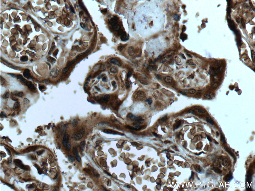 SPRYD5 Polyclonal antibody