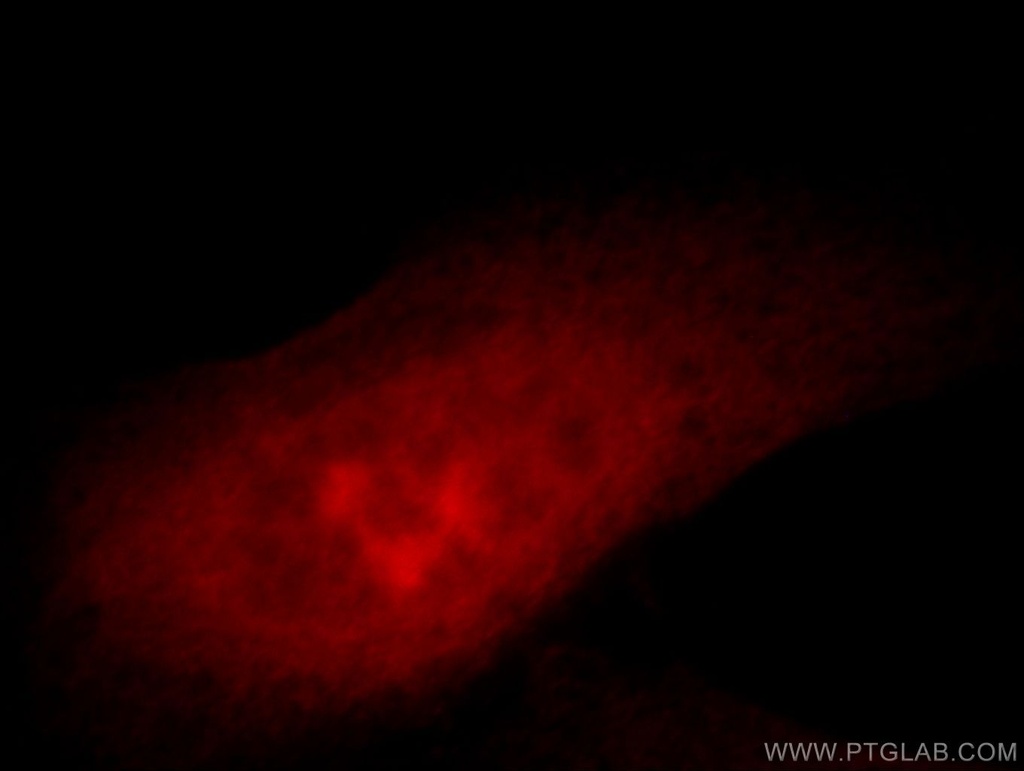 ZNF622 Polyclonal antibody