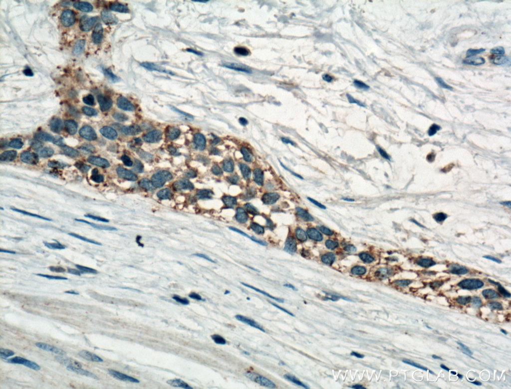 MT2A Polyclonal antibody