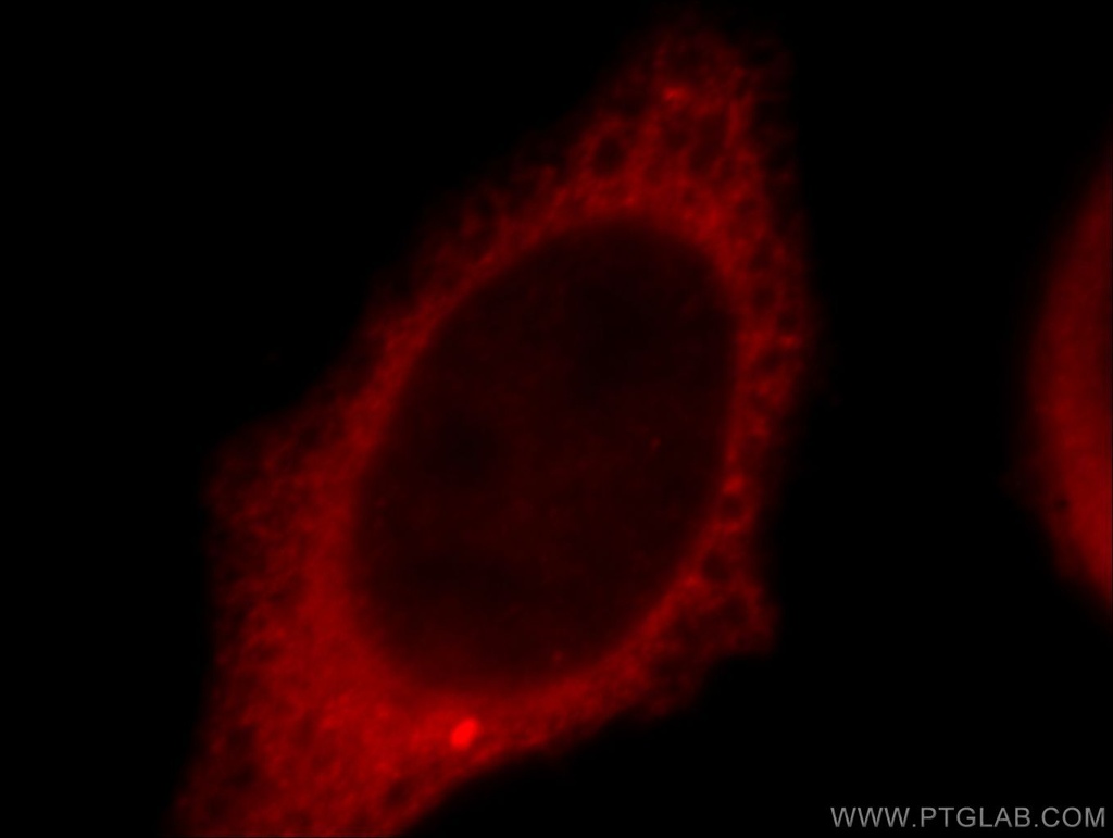 TXNDC17 Polyclonal antibody